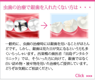 虫歯の治療で銀歯を入れたくない方は・・・