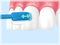 ブラッシング指導