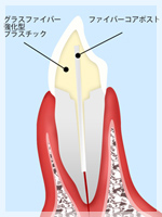 ファイバーコア